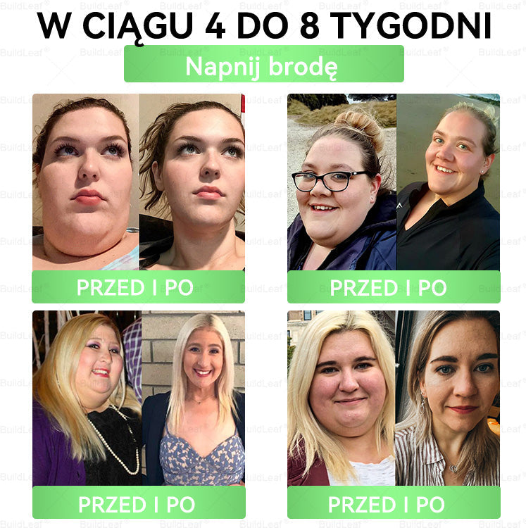 🍃Oficjalny sklep Polska | 🍃BuildLeaf® GLP-1 8-w-1 Fit & Vital Rozwiązanie (Jednorazowe dziennie, widoczne zmiany w ciągu 7 dni) ✅ Otyłość, zdrowie sercowo-naczyniowe, cukrzyca, bezdech senny, zdrowie jelit, problemy ze stawami i inne.