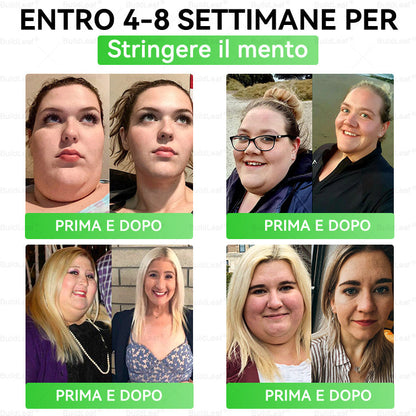 Negozio ufficiale | 👩‍⚕️BuildLeaf® GLP-1 8-in-1 Fit & Vital Soluzione Orale (Solo una volta al giorno, cambiamenti visibili in 7 giorni) ✅ Per obesità, salute cardiovascolare, diabete, apnea notturna, salute intestinale, problemi articolari e altro