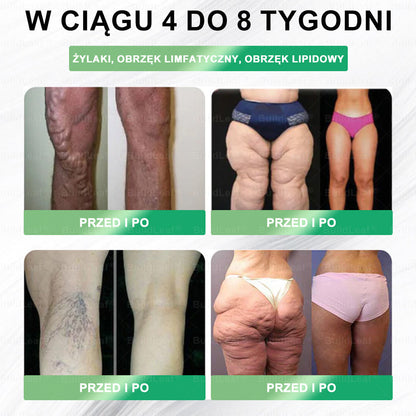 🍃Oficjalny sklep Polska | 🍃BuildLeaf® GLP-1 8-w-1 Fit & Vital Rozwiązanie (Jednorazowe dziennie, widoczne zmiany w ciągu 7 dni) ✅ Otyłość, zdrowie sercowo-naczyniowe, cukrzyca, bezdech senny, zdrowie jelit, problemy ze stawami i inne.